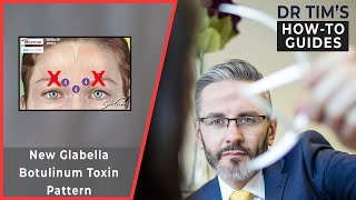 New Glabella Botulinum Toxin Pattern [upl. by Reinhard334]