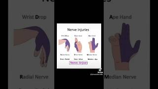 nerve injuries  wrist drop claw hand  ape hand medical reels anatomy [upl. by Rickie596]