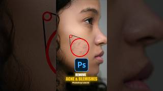 Remove Acne Blemishes under ONE minute photohop photoshoptutorial [upl. by Nyrahs269]