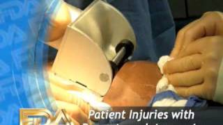 Avoiding Patient Injuries with Dermatome Instruments [upl. by Onateyac]