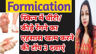 स्किन में चींटी कीड़े रेंगने का एहसास  Formication  वहम या भ्रम की बीमारी  Skin Formication [upl. by Treborsemaj]