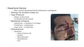 Choanal Atresia Oroantral Festula CSF Rhinorrhea Septal Hematoma Septal Abscess د ناصر العزيب [upl. by Kenzie]