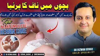 Expert advice on treating UMBILICAL HERNIA in infants👶 Umbilical hernia treatment [upl. by Warga319]