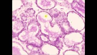 apocrine gland compound tubuloalveolar Mammary gland lactating [upl. by Amikahs]