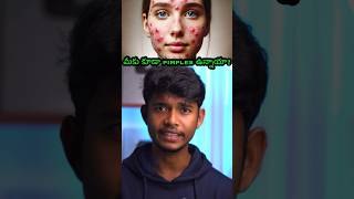 ✅Solution for Pimples osmdhruva telugu [upl. by Ieluuk673]