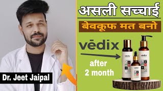 VEDIX Honest Review After 1 Month use  VEDIX Hair Product Review Result Dr Jeet Jaipal [upl. by Mullac665]