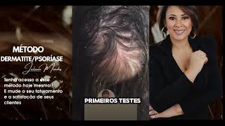 Método Dermatite  Psoriase [upl. by Adnarim]