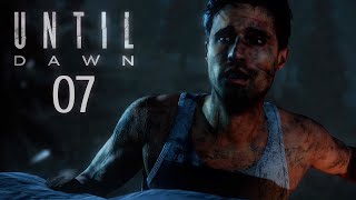 UNTIL DAWN 007  Heile Heile Körperteile ★ Lets Play Until Dawn [upl. by Daeriam]