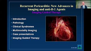 Recurrent Pericarditis New Advances in Imaging and AntiIL1 Agents [upl. by Lamrouex]