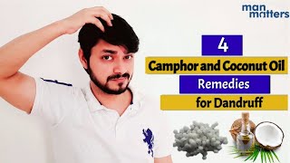 Remove dandruff permanently with Coconut oil and Camphor  Man Matters [upl. by Asihtal897]