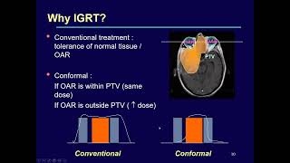 Image Registration in Radiotherapy  K J Maria Das [upl. by Aicylla]