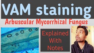 Staining of Arbuscular Mycorrhizal FungusVAMHariom LondheRohit Mane Scientistracademy [upl. by Bjork]