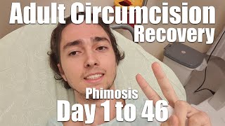 Adult Circumcision Recovery Experience  Day 1 to 46 Phimosis 21yo [upl. by Rehpotirhc]