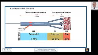 Ischemia Due to Coronary Microvascular Dysfunction CMVD Including INOCA amp ANOCA [upl. by Luhem]