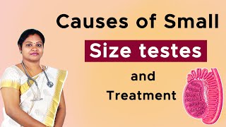 Causes of Small volume testis and treatment  DrPIswarya Devi MDs [upl. by Mw]