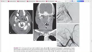 EMERGENCY RADIOLOGY REQUISITES [upl. by Anorahs]