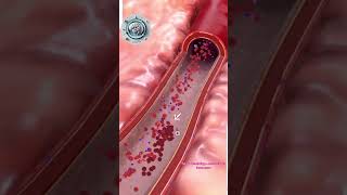 Dual anti platelet Therapy’s Affect on Blood Vessels stroke platelets neurology [upl. by Elbon273]