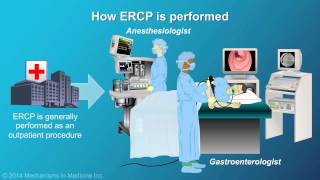 Understanding ERCP Endoscopic Retrograde Cholangiopancreatography [upl. by Naginnarb]