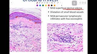 MSS pathology lab 1  part 1 [upl. by Anuaik]