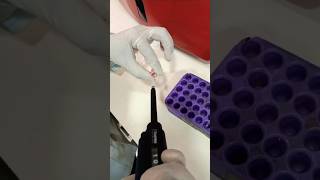 HBA1C TESTING hospital laboratorylife science medicallaboratory sciencelab lab [upl. by Ettelra]