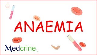 Anemia  causes classification clinical features treatment [upl. by Alfreda]