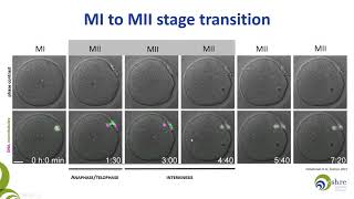 The importance of being mature Oocyte maturity assessment in clinical practice [upl. by Aisital]