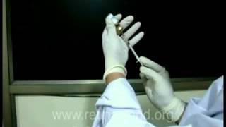 INTRAVITREAL INJECTION PREPARATION [upl. by Eissat]