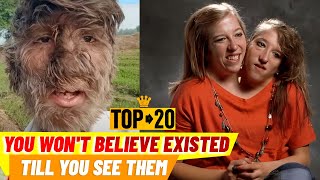 10 People You Wont Believe Existed Till You See Them [upl. by Zandra]