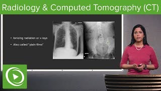 Radiology and Computed Tomography CT – Radiology  Lecturio [upl. by Tugman]