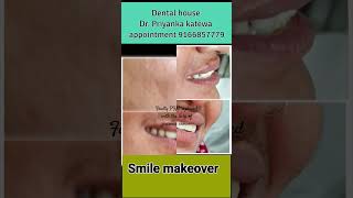 Smile design treatment with the help of zirconia crown jaipur dentist cosmeticdentistry [upl. by Rhoades]