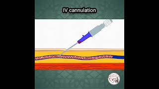 💉 INTRAVENOUS IV CANNULATION ANIMATION [upl. by Bagley]