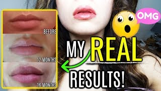 How To Get Plump Lips PERMANENTLY  BEFORE AND AFTER [upl. by Asirac879]