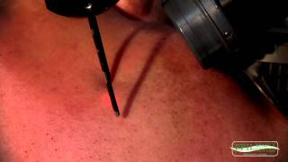 LASER DEPILAZIONE VISO Epilbeauty Tel 0541787808 [upl. by Sauls]