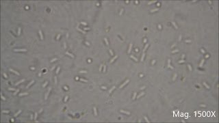 Bacteria under the Microscope E coli and S aureus [upl. by Merrily]