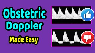 Obstetric Doppler Made Easy [upl. by Ittam]