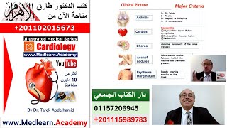 Rheumatic Fever usmle internalmedicine cme medicaleducation ecg محاضراتباطنة medical [upl. by Ervine790]