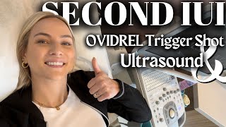 SECOND IUI CYCLE  Ovidrel Trigger Shot  TTC Journey  Unexplained Infertility [upl. by Barbee79]