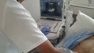 TAPONAMIENTO CARDIACO Dr Salek Ali [upl. by Harihs]