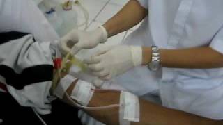 HEMODIALYSIS Procedure [upl. by Nanis]