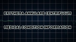 Erythema annulare centrifugum Medical Condition [upl. by Nugesulo310]