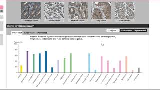 Cancer Bioinformatics Pt3 NCBI and The Human Protein Atlas [upl. by Loutitia129]