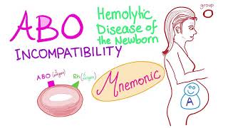 ABO incompatibility mnemonic [upl. by Fiorenza298]