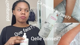 lévolution de ma peau avec Topicrem mela  début dutilisation [upl. by Phira]