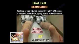 Dial Test  Everything You Need To Know  Dr Nabil [upl. by Ransell707]