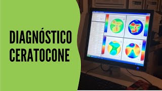 Como é identificado e realizado o diagnóstico do Ceratocone [upl. by Avirt889]