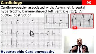 internalmedicine cme usmle محاضراتباطنة ecg كورساتباطنة clinical clinical medicine [upl. by Glenden354]