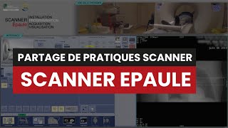 CT SCANNER EPAULE  Partage de pratique [upl. by Emily]