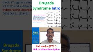 Brugada Syndrome [upl. by Aztinaj]