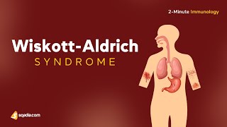 WiskottAldrich Syndrome  2Minute Immunology  USMLE  VLearning™ [upl. by Attennod]