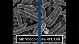 All About Escherichia Coli amp Escherichia Coli Infection E Coli [upl. by Naedan]